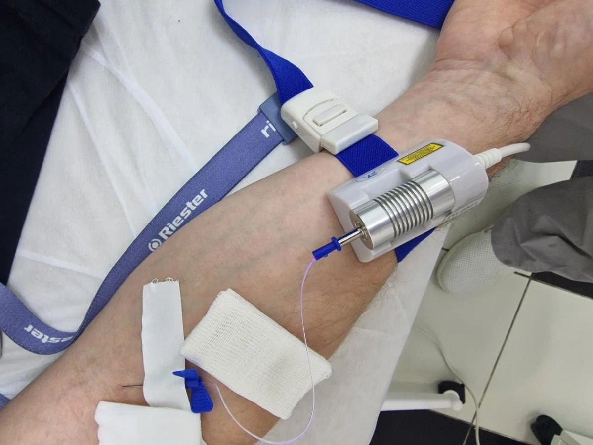 Облучение крови Облучение крови